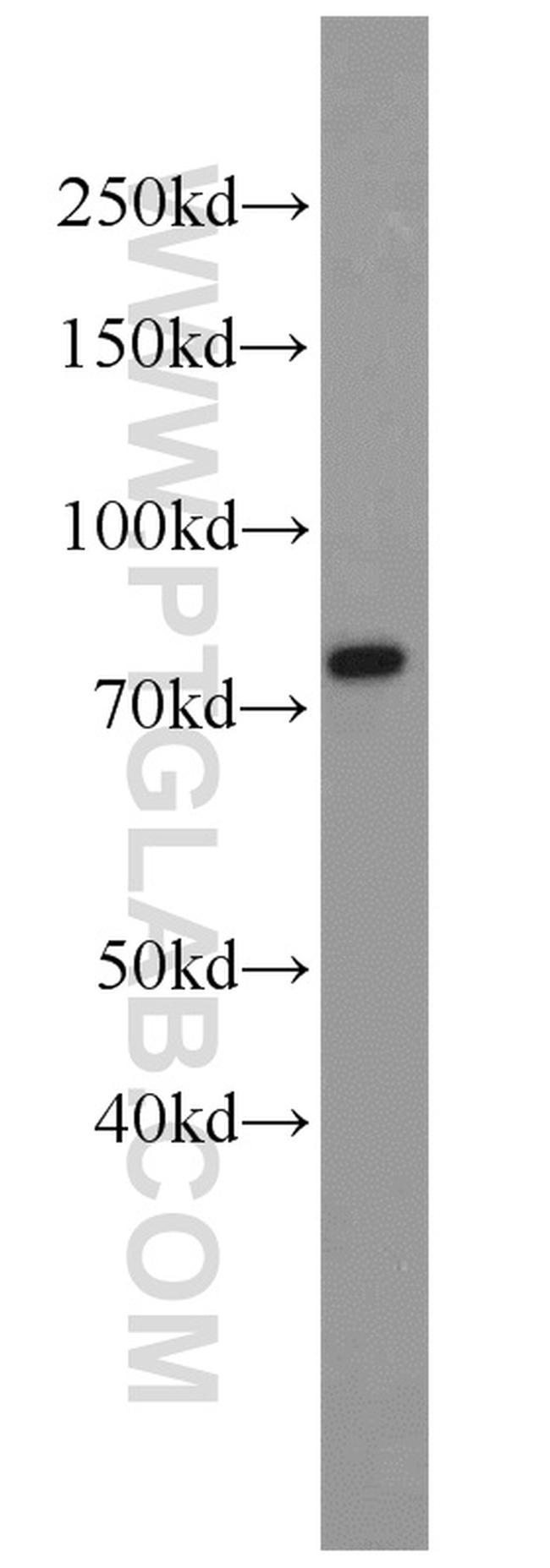 GRP78/BIP Antibody in Western Blot (WB)