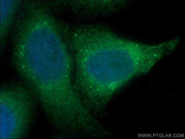 GRP78/BIP Antibody in Immunocytochemistry (ICC/IF)