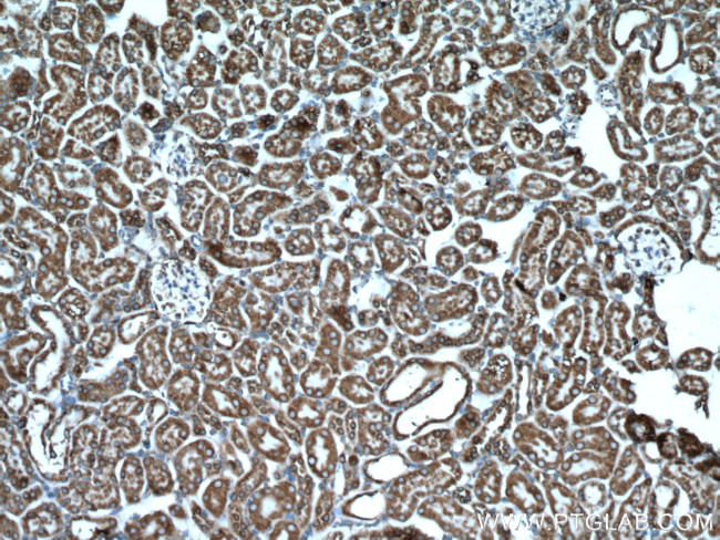 GRP78/BIP Antibody in Immunohistochemistry (Paraffin) (IHC (P))