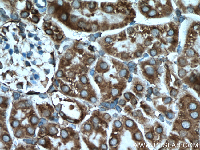 GRP78/BIP Antibody in Immunohistochemistry (Paraffin) (IHC (P))