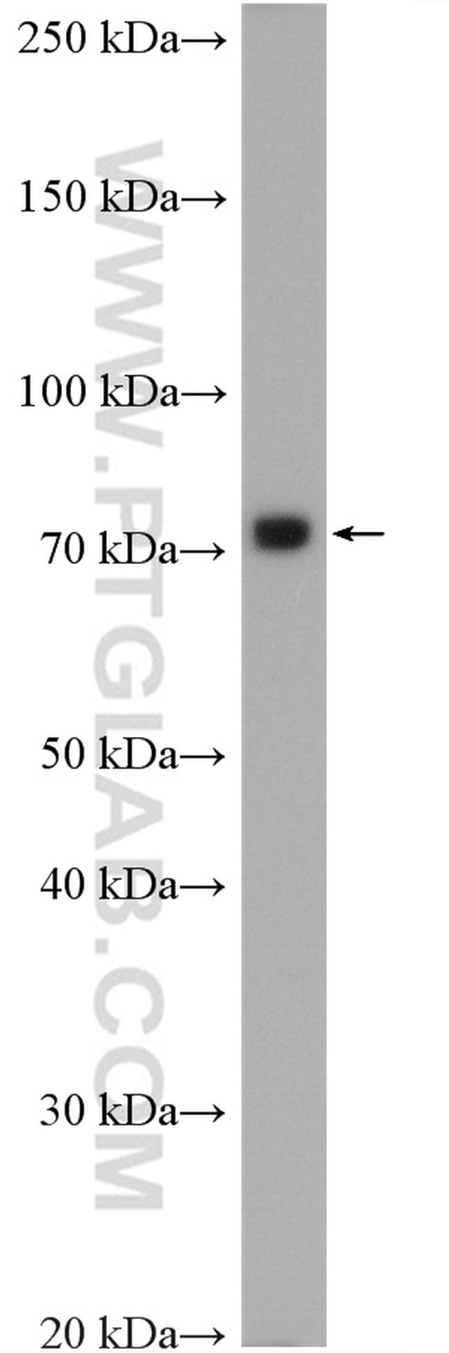 GRP78/BIP Antibody in Western Blot (WB)