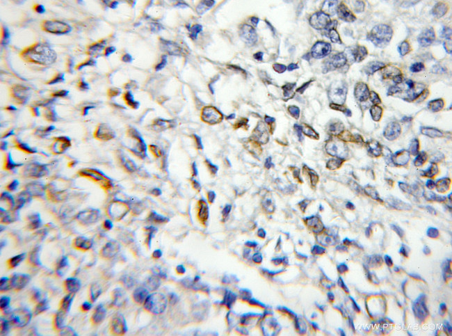 RABL2B Antibody in Immunohistochemistry (Paraffin) (IHC (P))