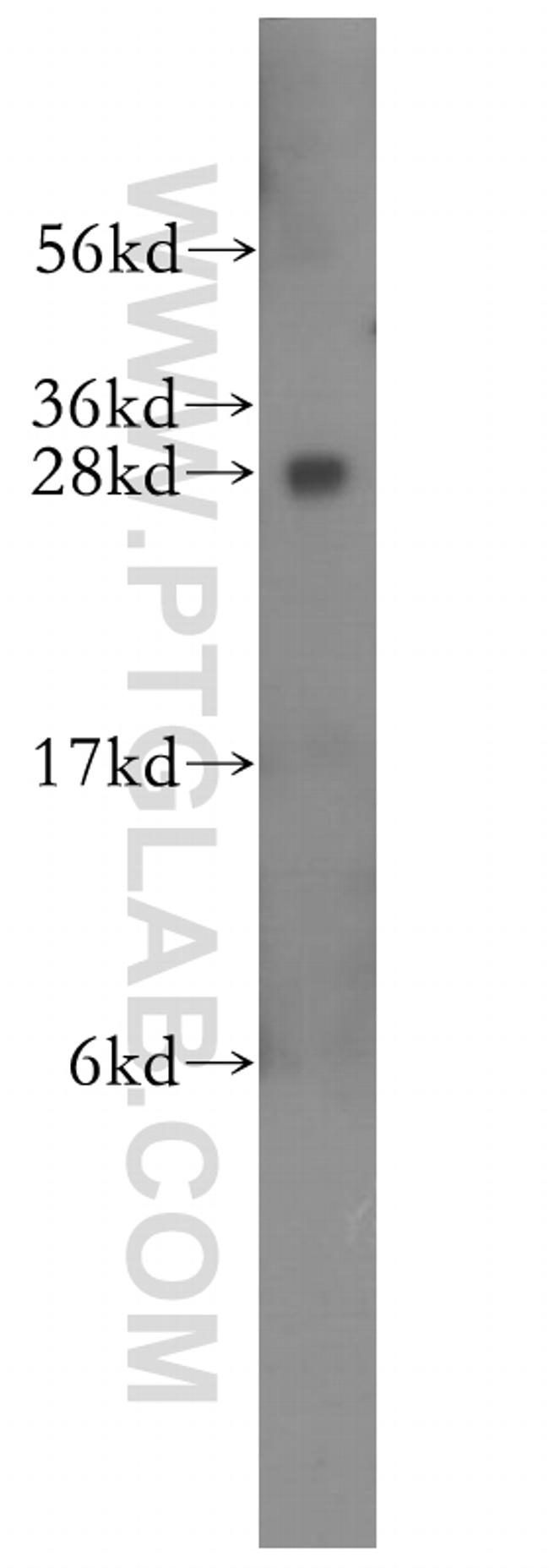 RABL2B Antibody in Western Blot (WB)