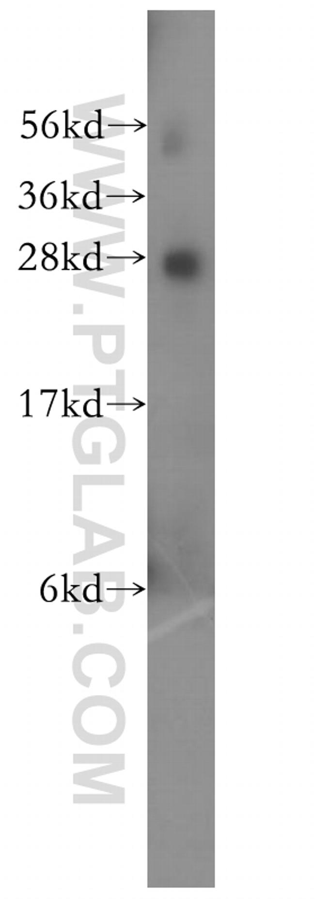 RABL2B Antibody in Western Blot (WB)