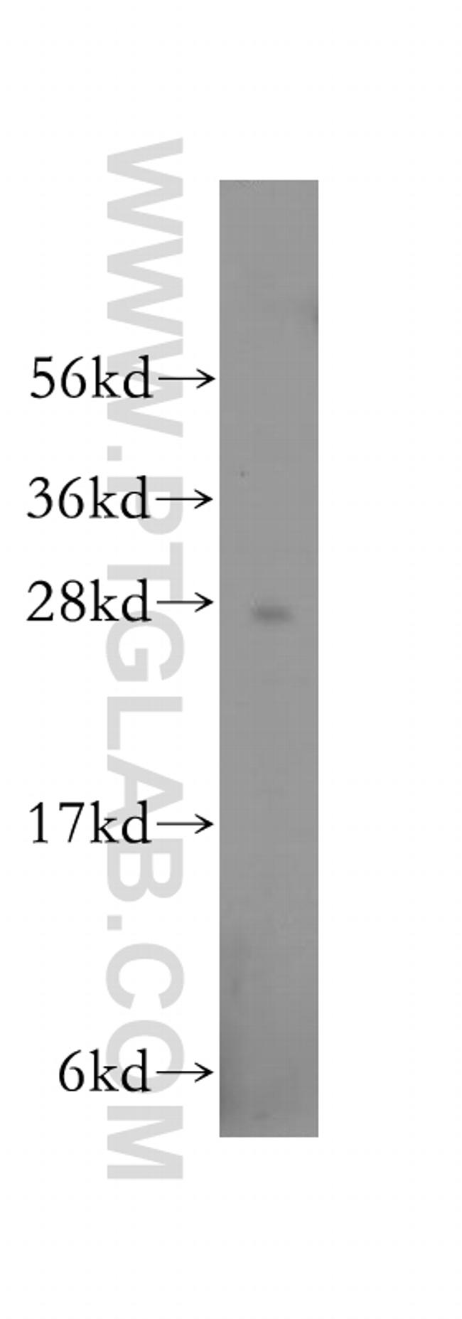 RABL2B Antibody in Western Blot (WB)