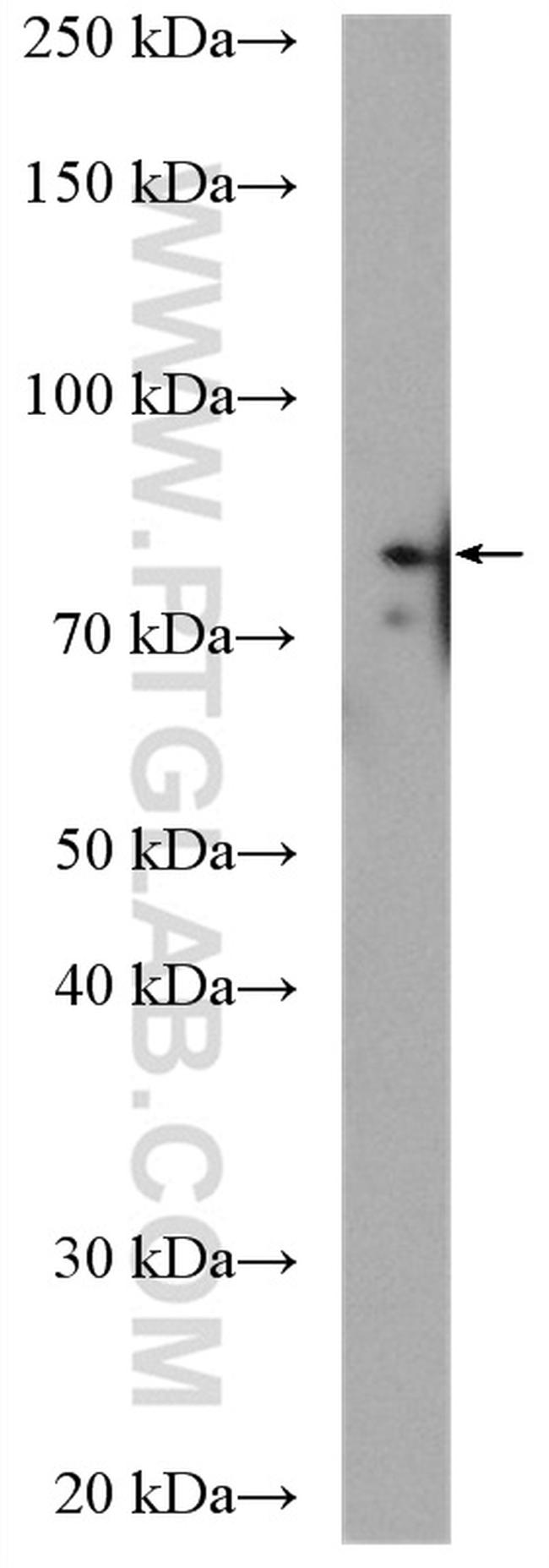 BRSK2 Antibody in Western Blot (WB)