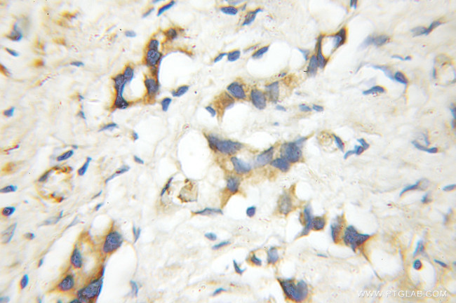 RGS5 Antibody in Immunohistochemistry (Paraffin) (IHC (P))