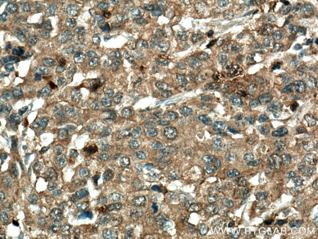 RGS5 Antibody in Immunohistochemistry (Paraffin) (IHC (P))