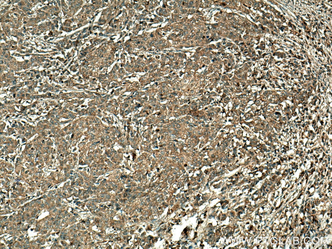 RGS5 Antibody in Immunohistochemistry (Paraffin) (IHC (P))