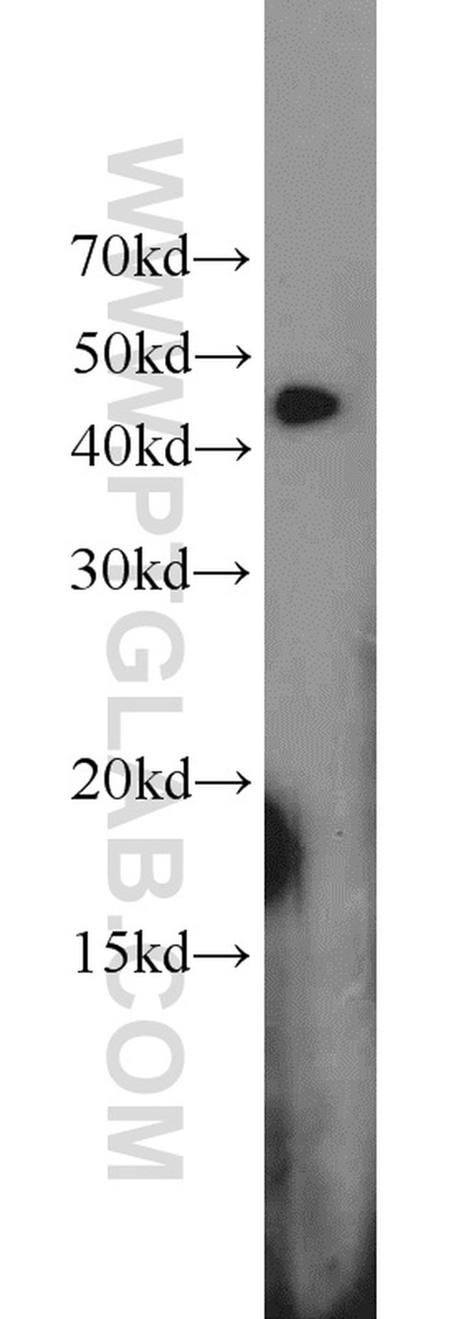 RGS5 Antibody in Western Blot (WB)