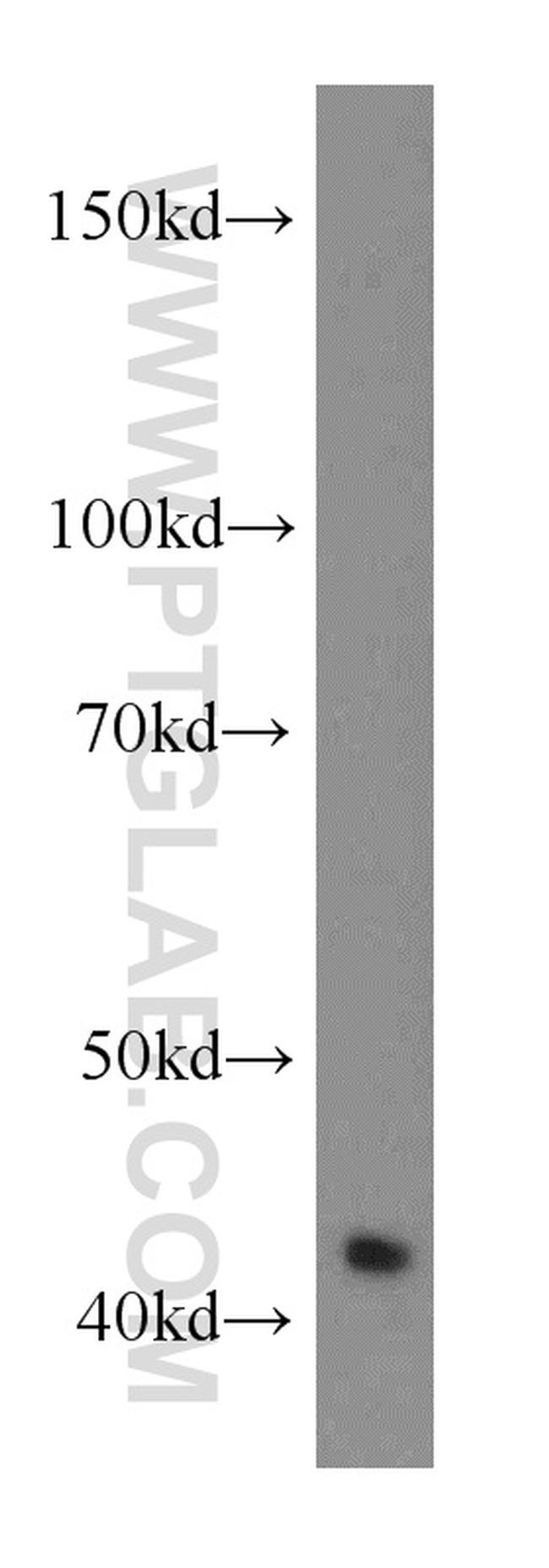 RGS5 Antibody in Western Blot (WB)