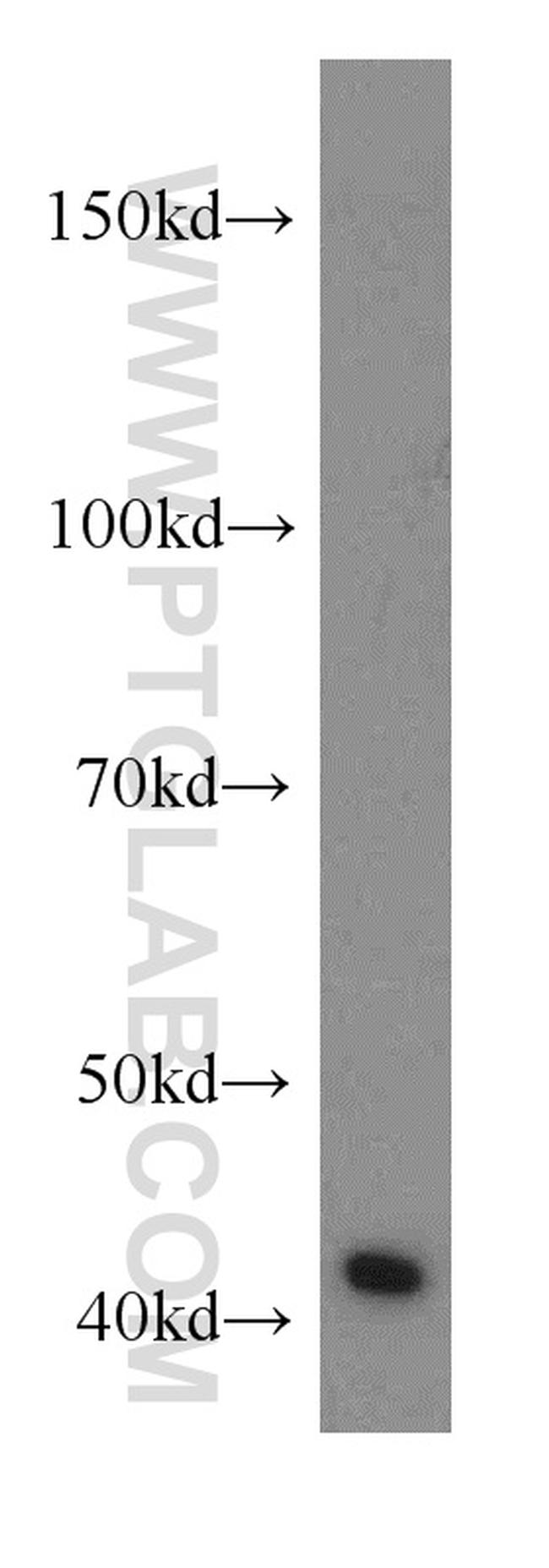 RGS5 Antibody in Western Blot (WB)