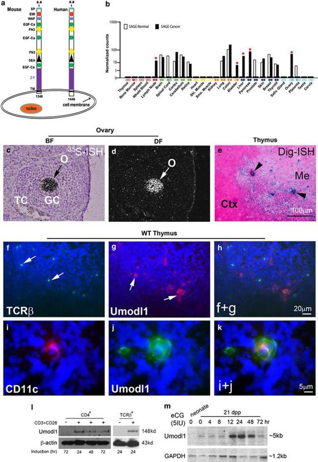 TCR beta Antibody in Western Blot, Immunohistochemistry (WB, IHC)