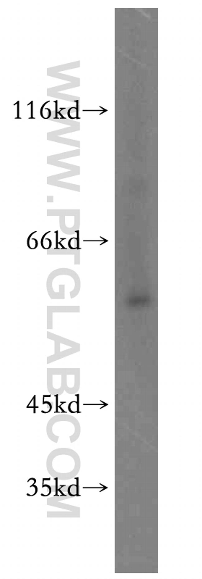 HCK Antibody in Western Blot (WB)