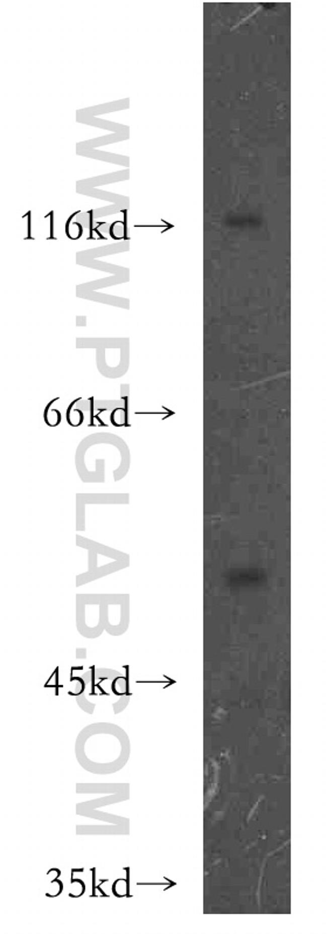 HCK Antibody in Western Blot (WB)