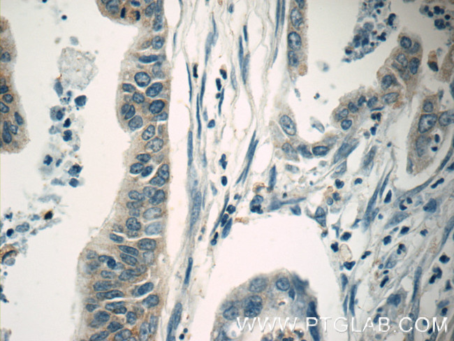 IGF2BP2 Antibody in Immunohistochemistry (Paraffin) (IHC (P))