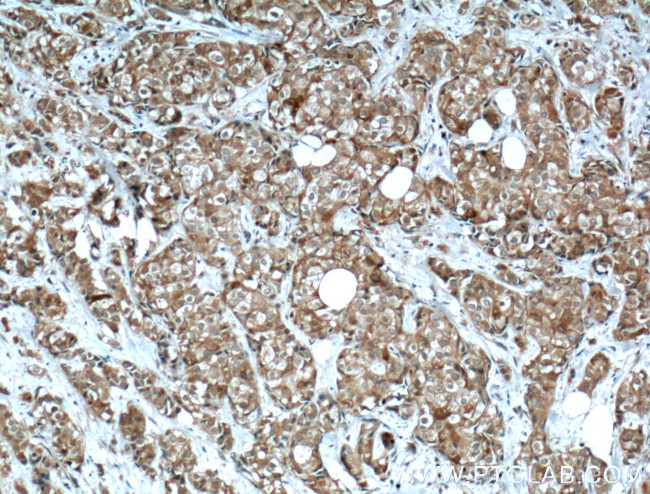 IGF2BP2 Antibody in Immunohistochemistry (Paraffin) (IHC (P))