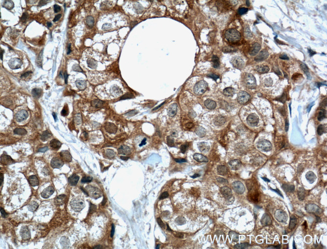 IGF2BP2 Antibody in Immunohistochemistry (Paraffin) (IHC (P))