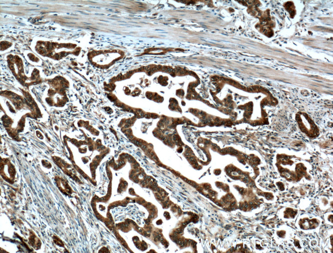 IGF2BP2 Antibody in Immunohistochemistry (Paraffin) (IHC (P))