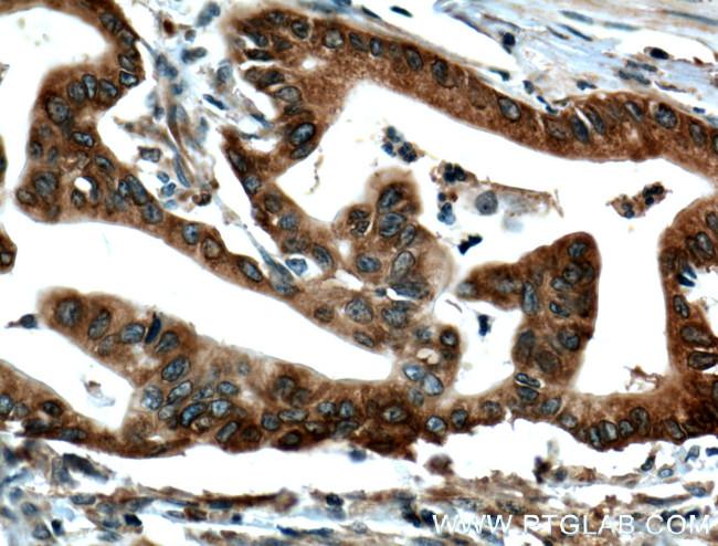 IGF2BP2 Antibody in Immunohistochemistry (Paraffin) (IHC (P))