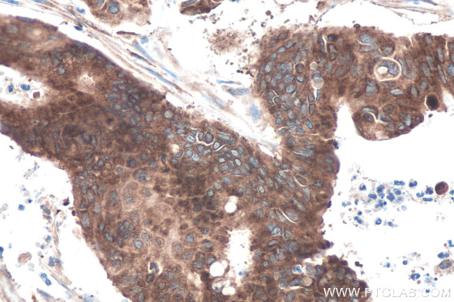 IGF2BP2 Antibody in Immunohistochemistry (Paraffin) (IHC (P))