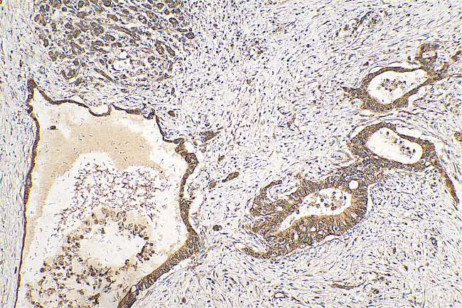 IGF2BP2 Antibody in Immunohistochemistry (Paraffin) (IHC (P))