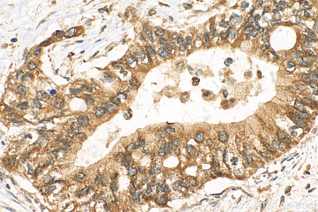 IGF2BP2 Antibody in Immunohistochemistry (Paraffin) (IHC (P))