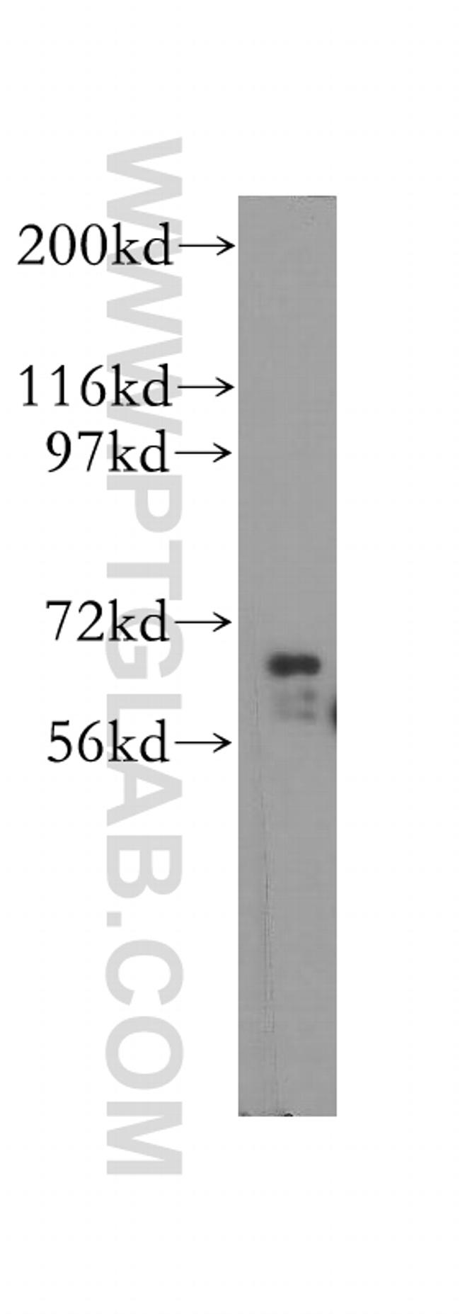 IGF2BP2 Antibody in Western Blot (WB)