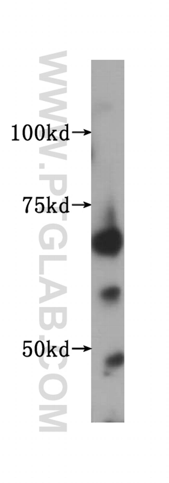 IGF2BP2 Antibody in Western Blot (WB)