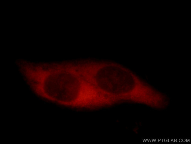 CCT5 Antibody in Immunocytochemistry (ICC/IF)