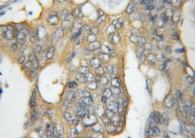 CCT5 Antibody in Immunohistochemistry (Paraffin) (IHC (P))