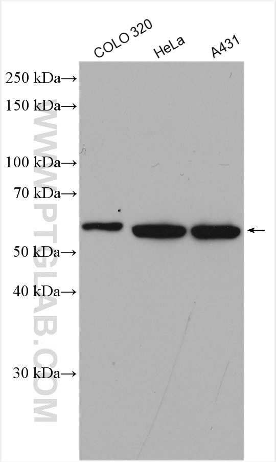 CCT5 Antibody in Western Blot (WB)