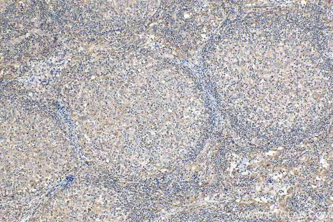 Cyclophilin B Antibody in Immunohistochemistry (Paraffin) (IHC (P))