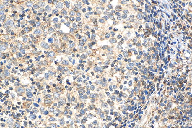 Cyclophilin B Antibody in Immunohistochemistry (Paraffin) (IHC (P))