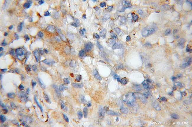 Cyclophilin B Antibody in Immunohistochemistry (Paraffin) (IHC (P))