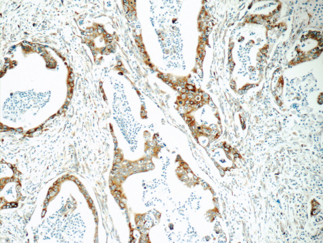 Cyclophilin B Antibody in Immunohistochemistry (Paraffin) (IHC (P))