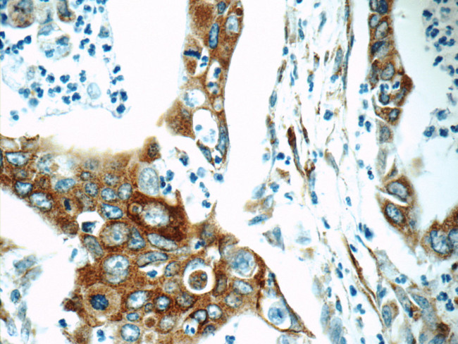 Cyclophilin B Antibody in Immunohistochemistry (Paraffin) (IHC (P))