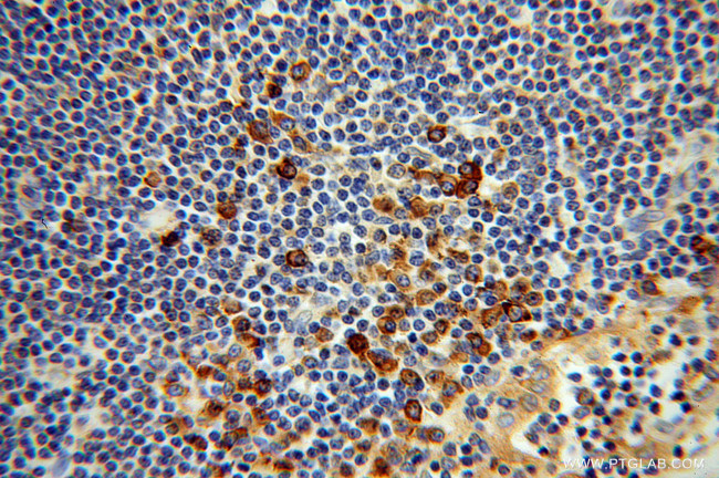 Cyclophilin B Antibody in Immunohistochemistry (Paraffin) (IHC (P))