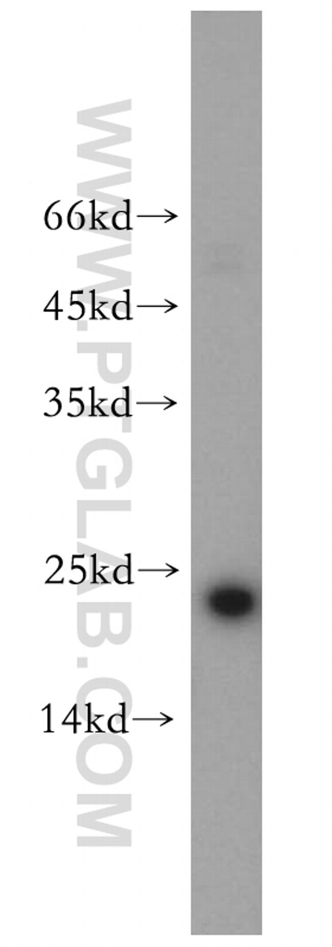 Cyclophilin B Antibody in Western Blot (WB)