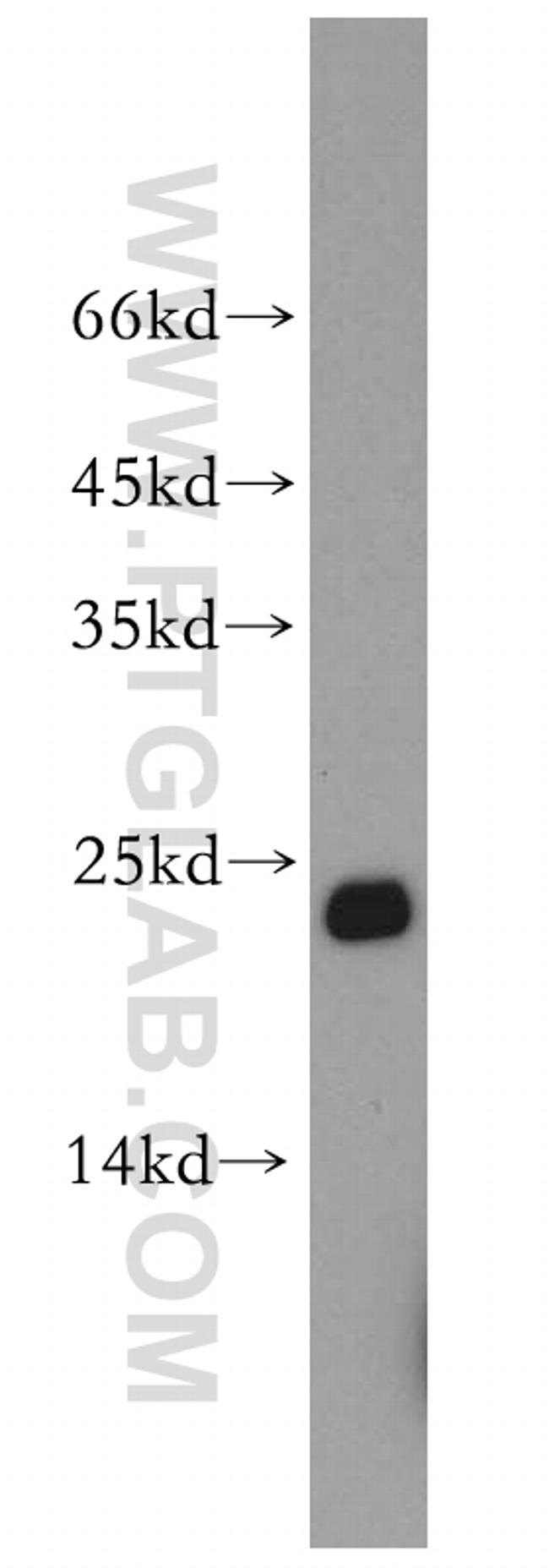 Cyclophilin B Antibody in Western Blot (WB)