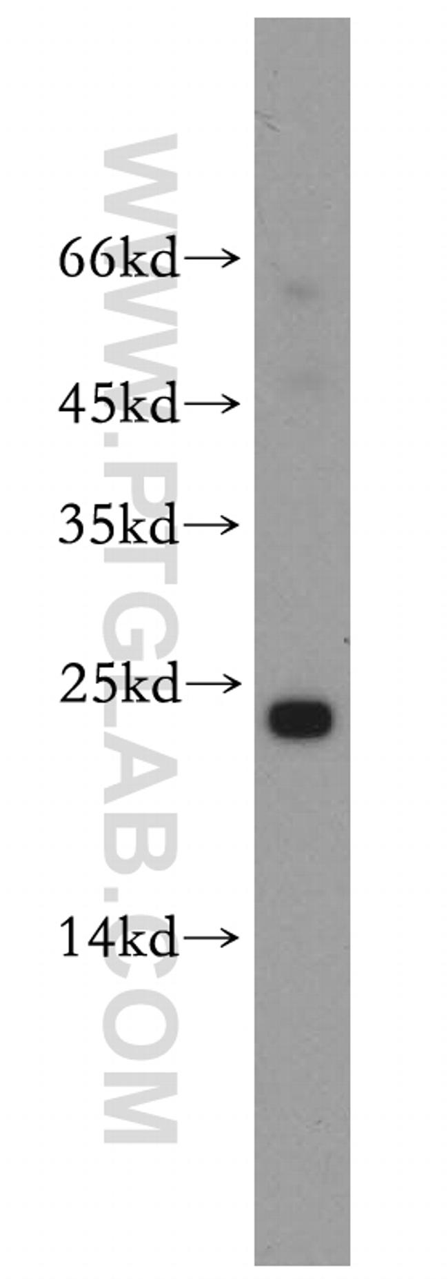 Cyclophilin B Antibody in Western Blot (WB)