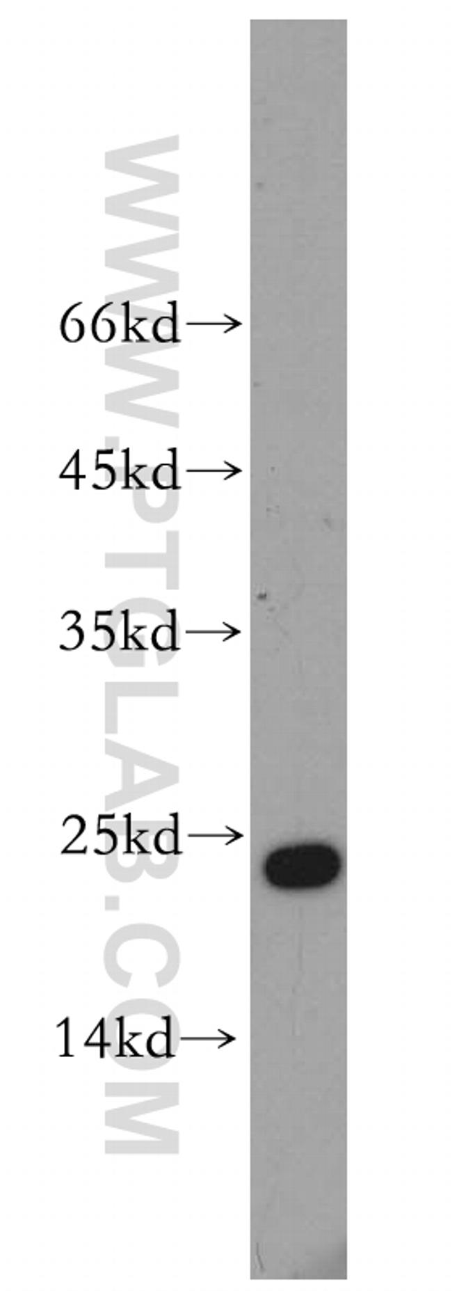 Cyclophilin B Antibody in Western Blot (WB)