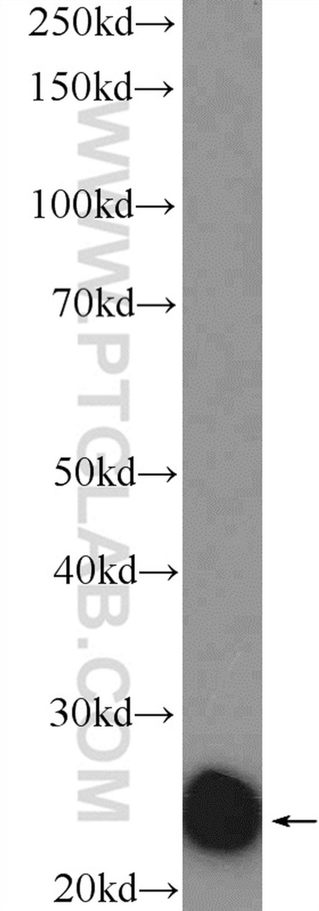 Cyclophilin B Antibody in Western Blot (WB)