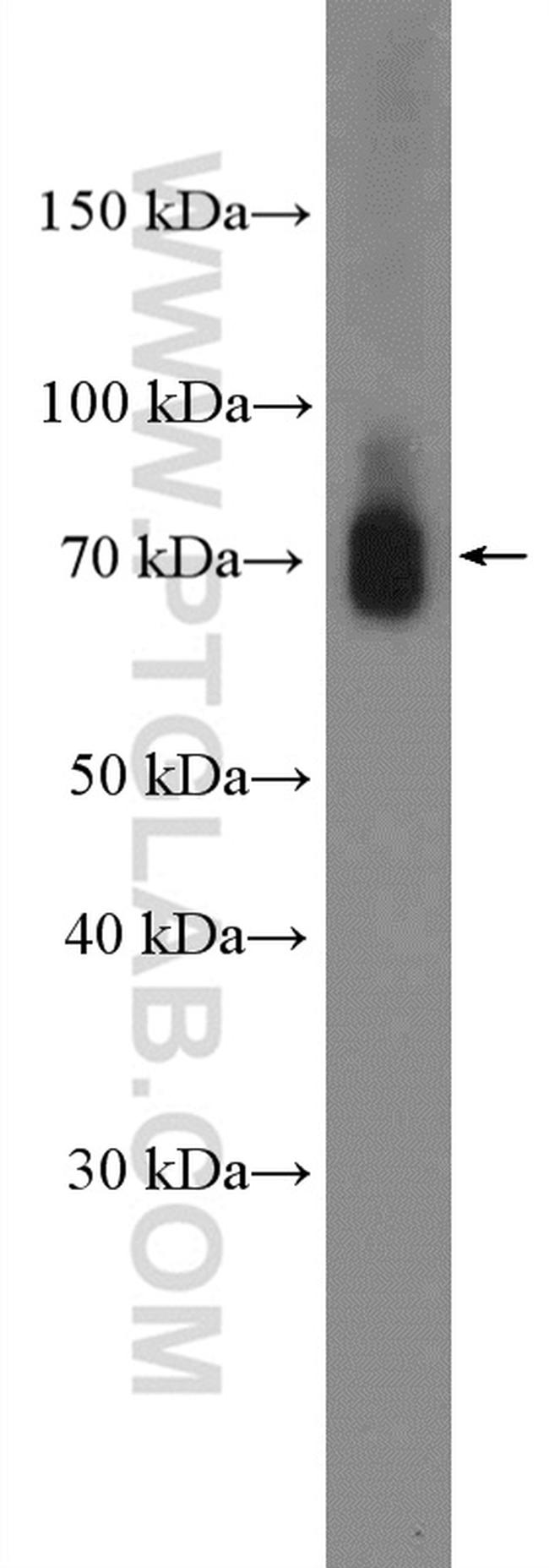 CPSF3 Antibody in Western Blot (WB)