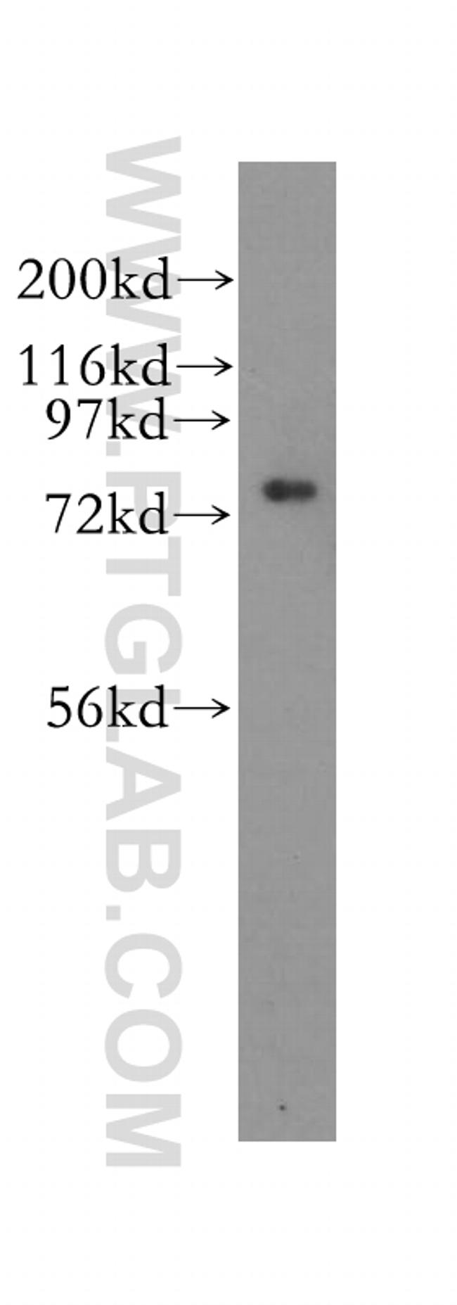 CPSF3 Antibody in Western Blot (WB)