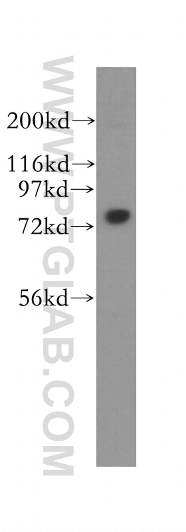 CPSF3 Antibody in Western Blot (WB)