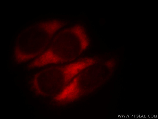 MTX2 Antibody in Immunocytochemistry (ICC/IF)