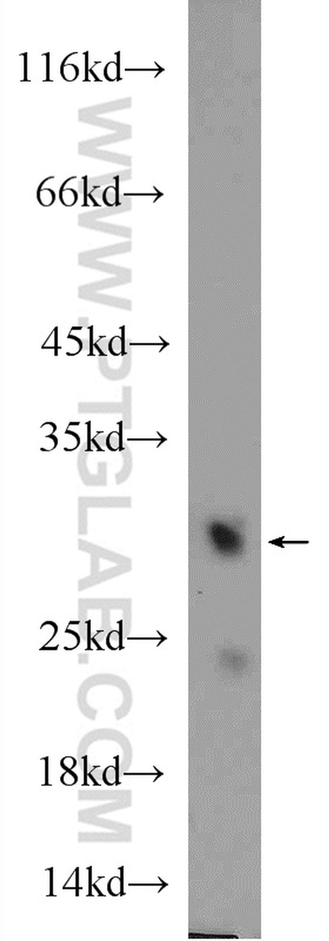 MTX2 Antibody in Western Blot (WB)