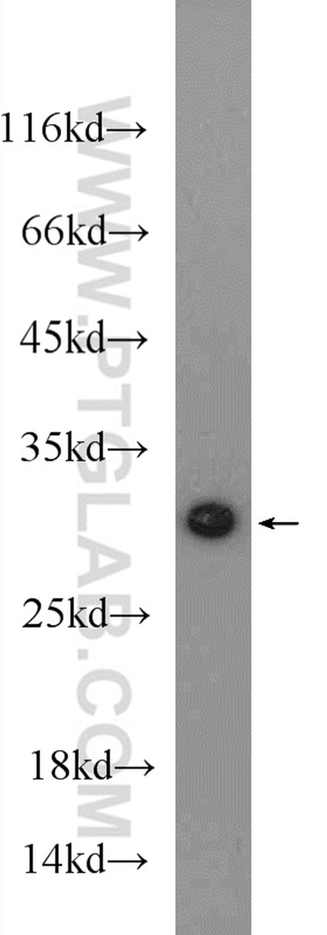 MTX2 Antibody in Western Blot (WB)