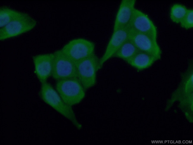 VPRBP Antibody in Immunocytochemistry (ICC/IF)